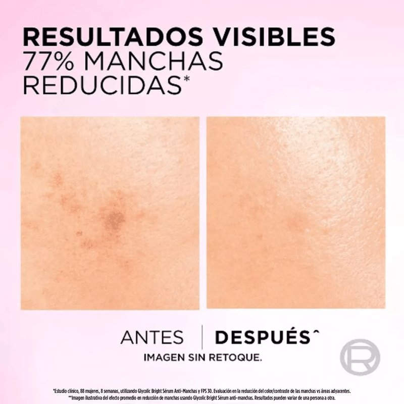 Cómo usar el ácido glicólico