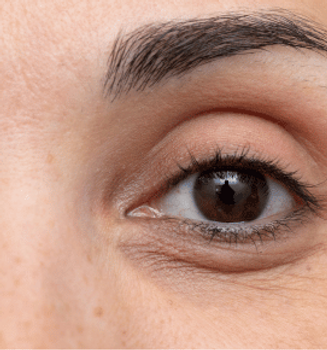 Productos Para Las Ojeras