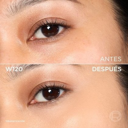 5 Antes Despues
