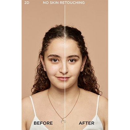 2W AMANDE Dore Before After 500px