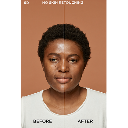 9W TERRE Before After 500px